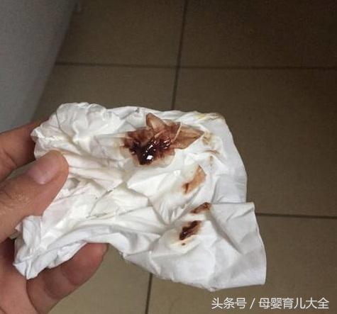 姨妈推迟内裤上出现褐色分泌物