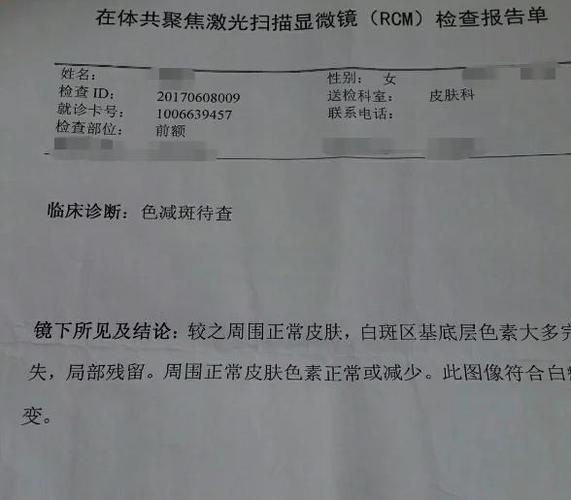 手机屏幕上有白点是怎么回事