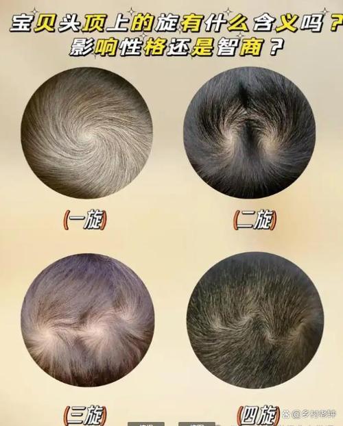 头旋顺时针和逆时针说法