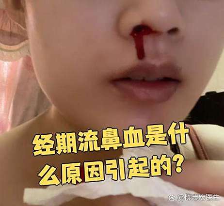 姨妈没来流鼻血了怎么回事