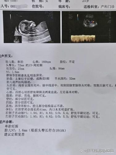 nt中文叫什么