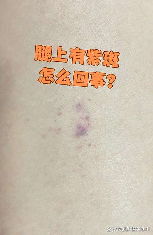 屏幕出现紫色的斑点