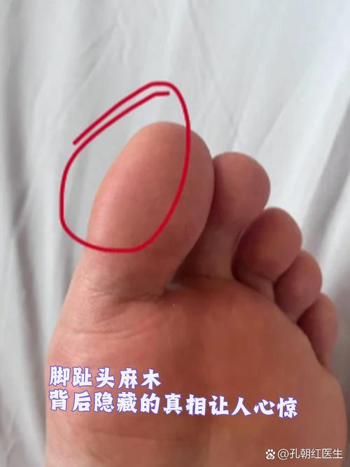 喜欢吸脚趾头的男人什么心理