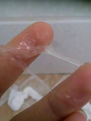 私处有白色分泌物是怎么回事