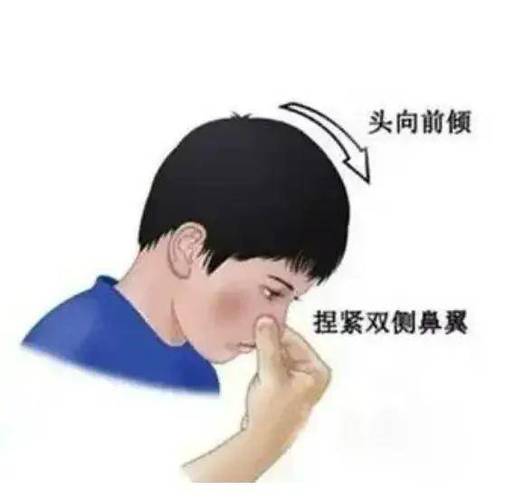 男生流鼻血的原因