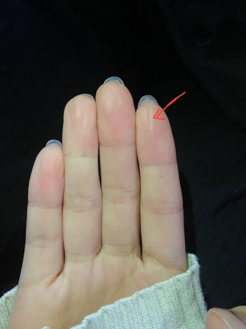 指纹上有竖纹怎么回事