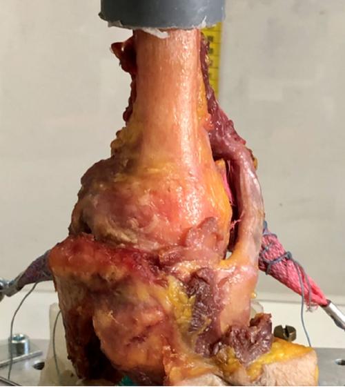 骨折模拟器下载