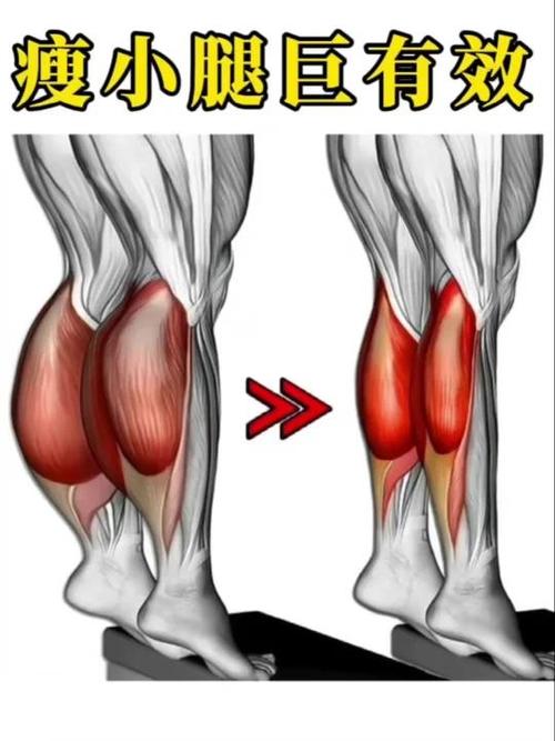 如何锻炼小腿肌肉增粗