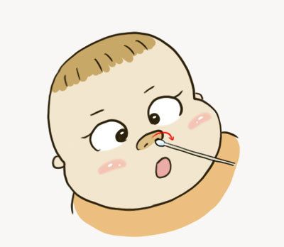 鼻子发痒揉鼻子流鼻血