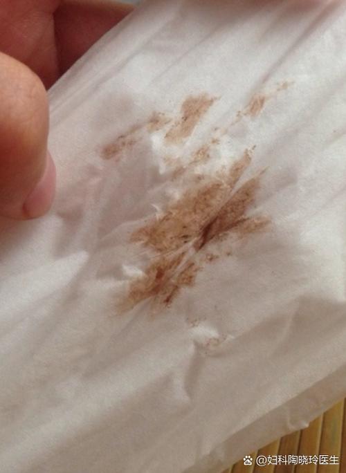 没来月经但是有褐色血