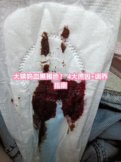 姨妈走后几天容易怀孕