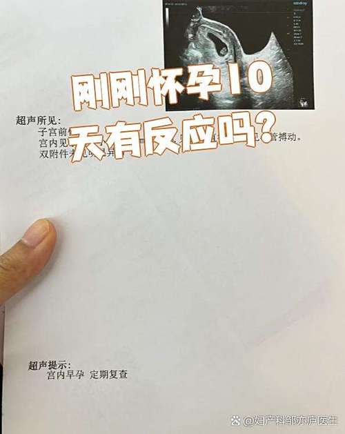 怀孕的初期症状