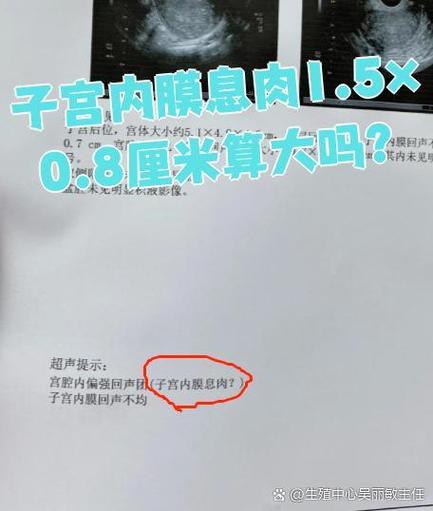 1.5×0.8