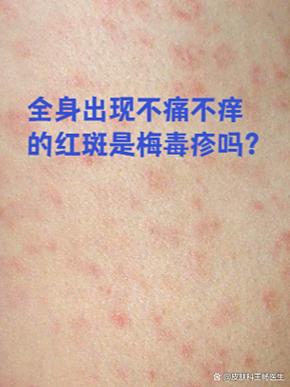 屏幕有红斑是怎么回事