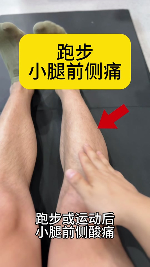 小腿肌肉酸痛