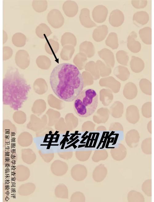 鼻子里面有血但是不流鼻血