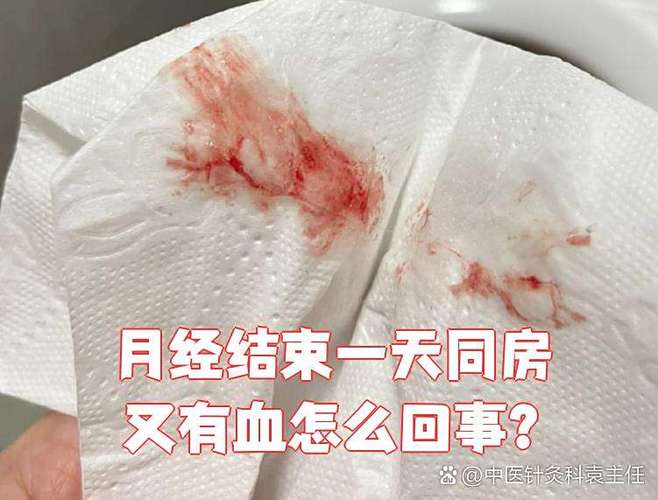快来姨妈了同房后有血水