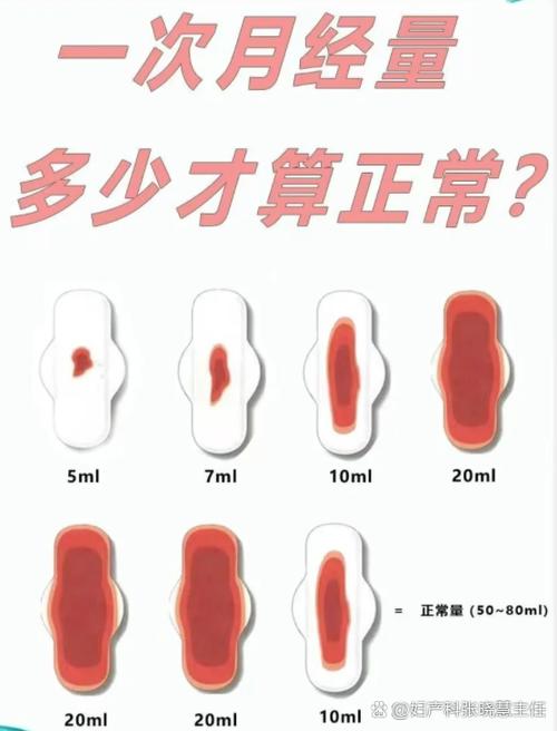 大姨妈什么程度叫血崩