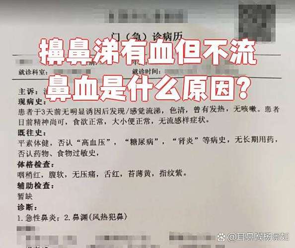 感冒了擤鼻涕有血但不流鼻血