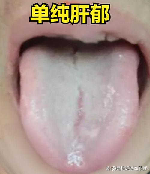 钢化膜用一段时间边缘起泡