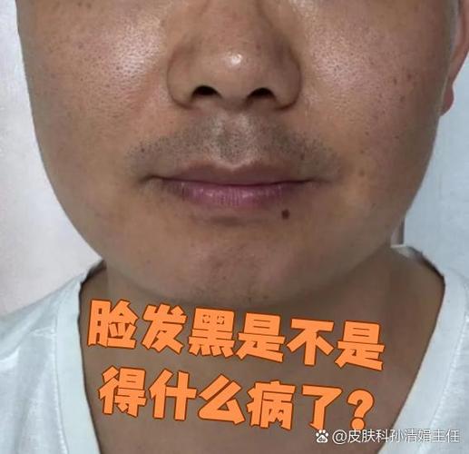 人脸越来越黑是什么原因