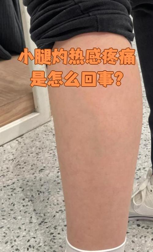 吃火锅后小腿肌肉酸痛
