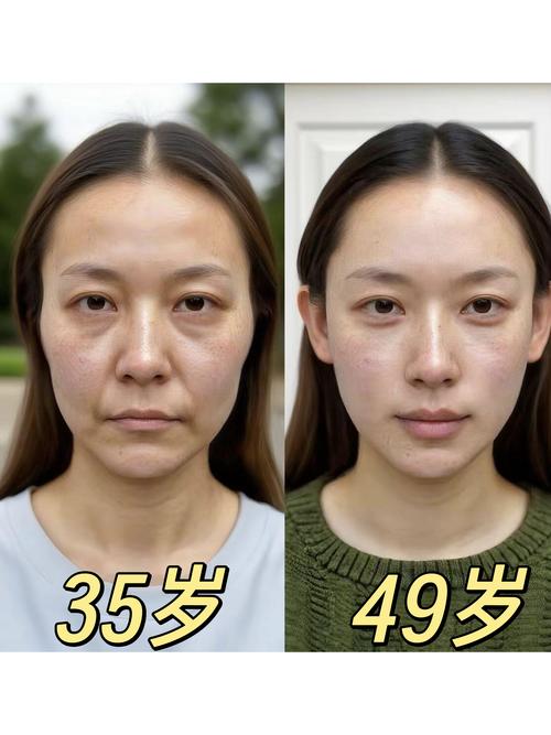 有面容和无面容价格差多少