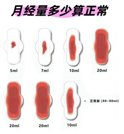 月经期量少怎么办