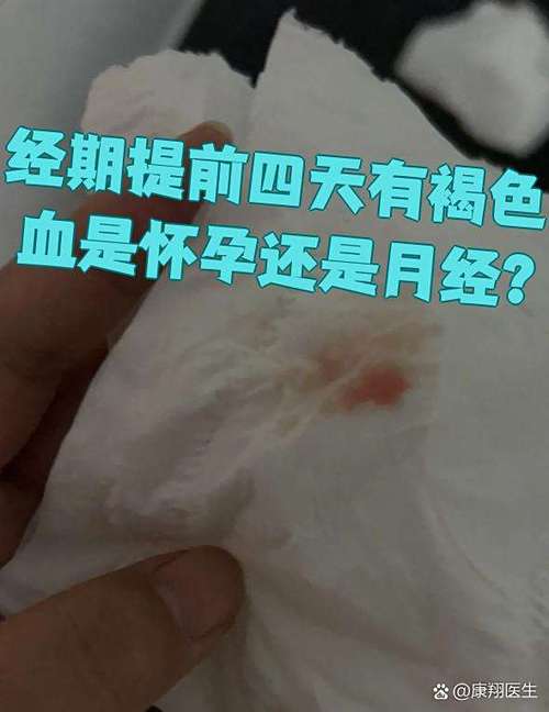 褐色的血是月经还是怀孕