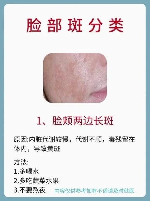 脸上斑块越来越大是什么原因