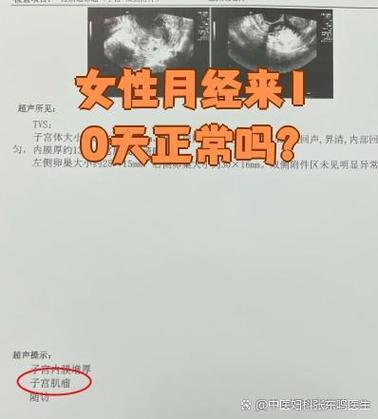 姨妈来10天正常吗