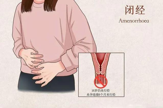 闭经四五年了突然又来了