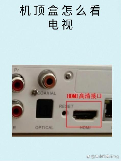 看电视需要机顶盒吗