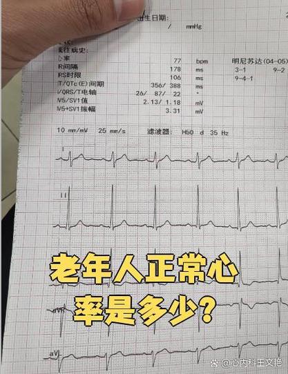70-80岁心率55_60是正常吗