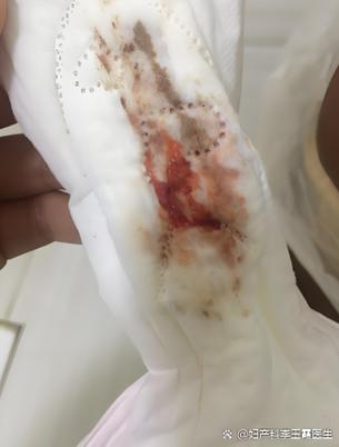 来姨妈怎么来了一点就没了