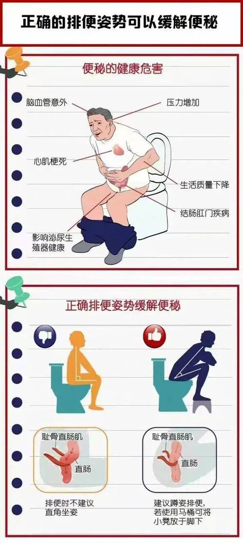 治疗便秘的方法