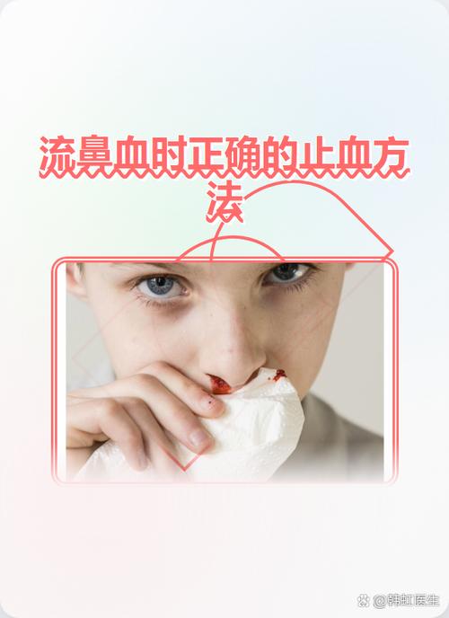 为啥擤鼻涕会流鼻血