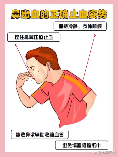 流鼻血站着还是坐着